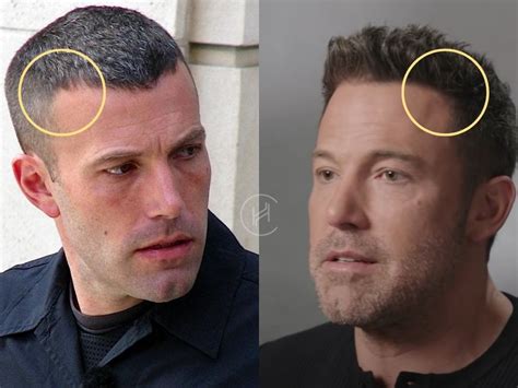 ben affleck hairpiece.